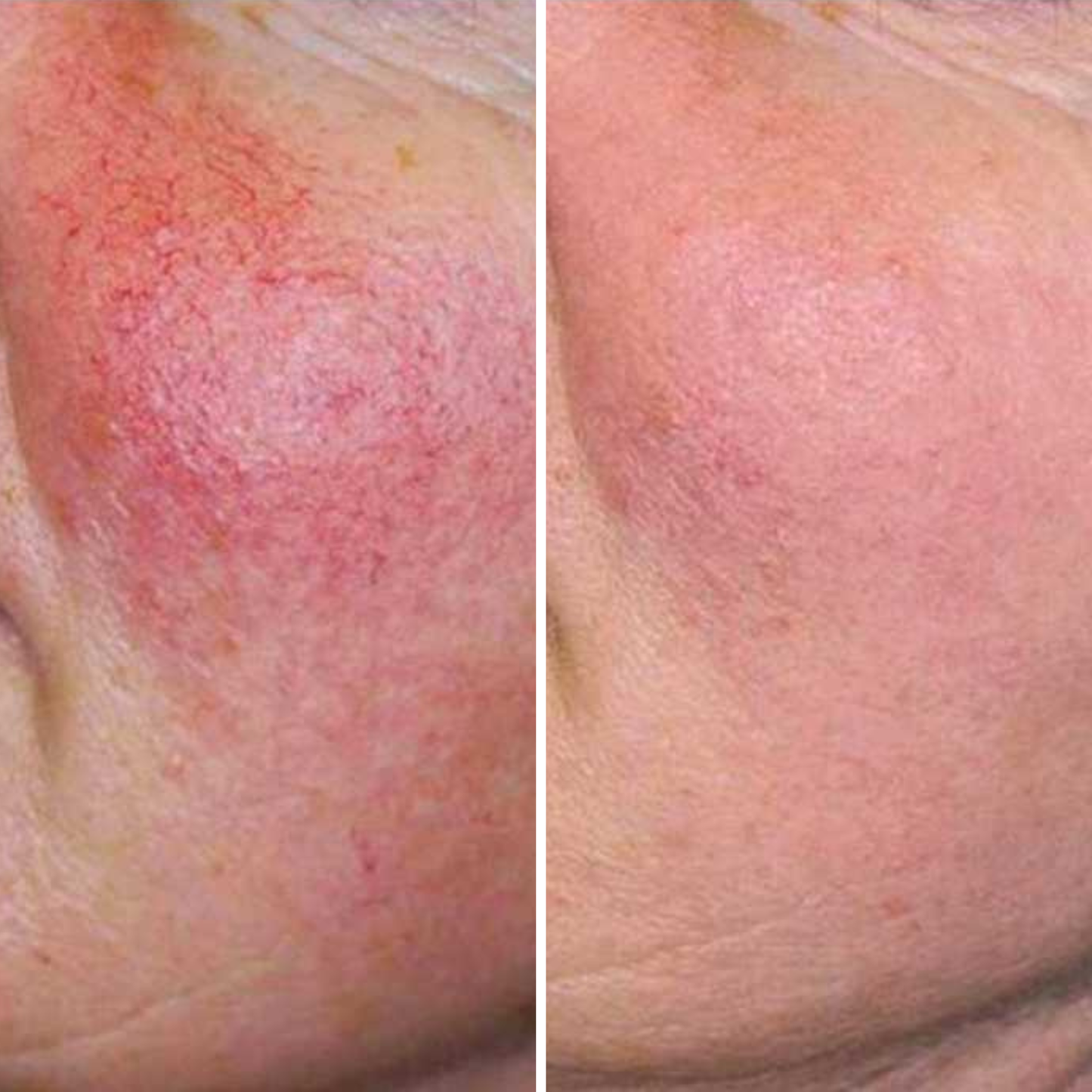 Kolaé Anti-Redness Serum