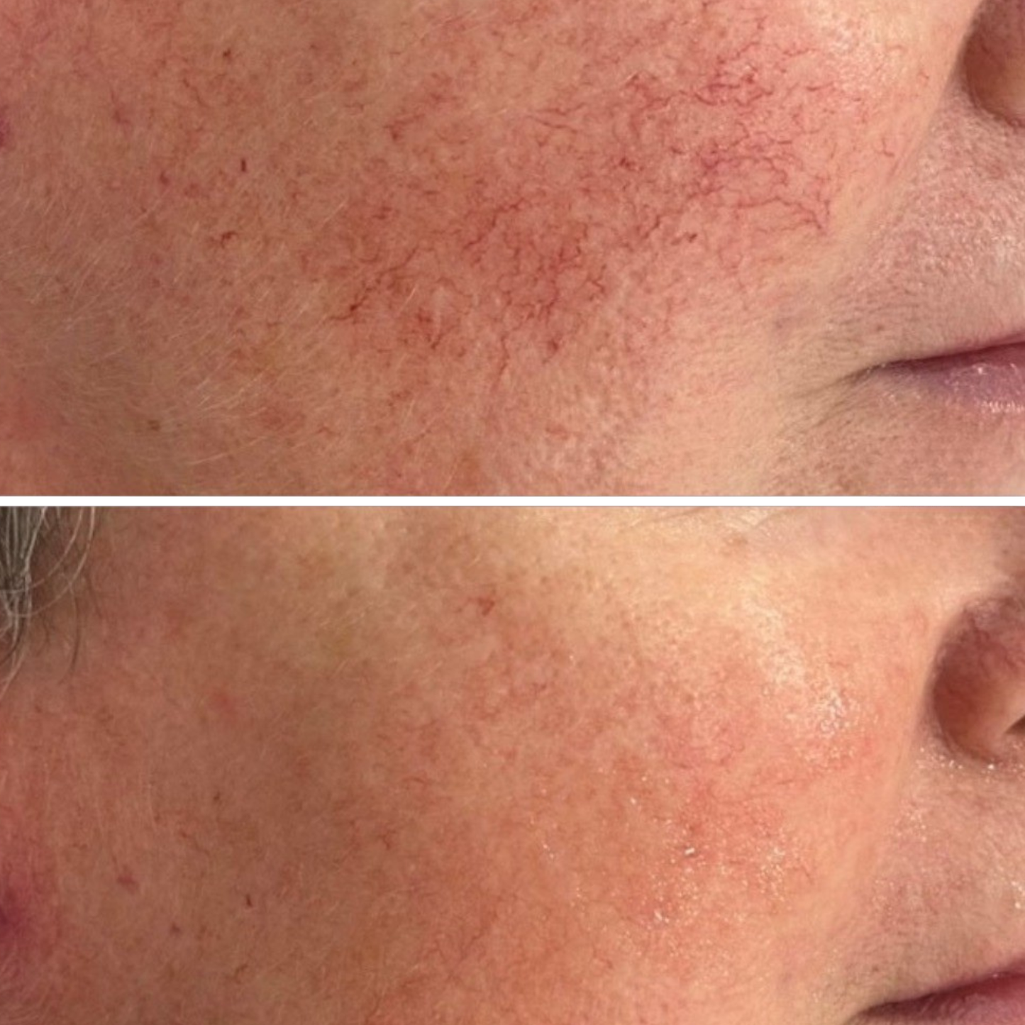 Kolaé Anti-Redness Serum