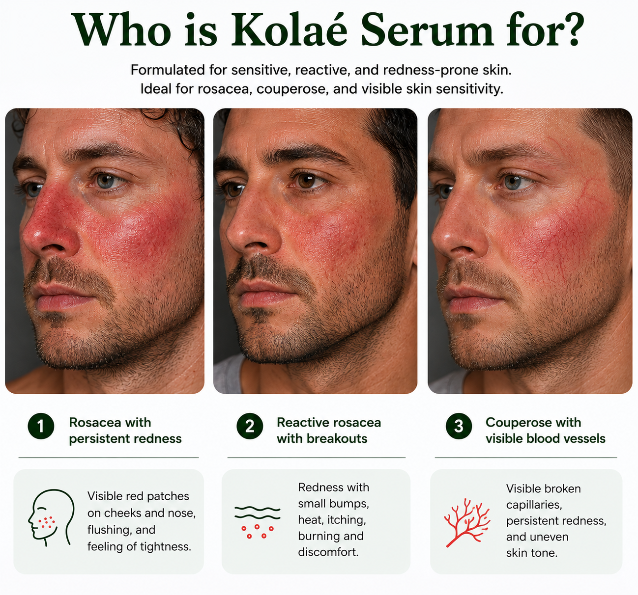 Kolaé Anti-Redness Serum Man