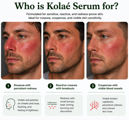Kolaé Anti-Redness Serum Man