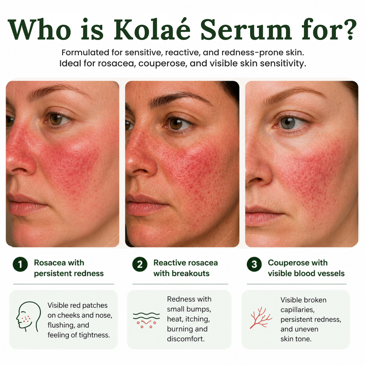 Kolaé Anti-Redness Serum