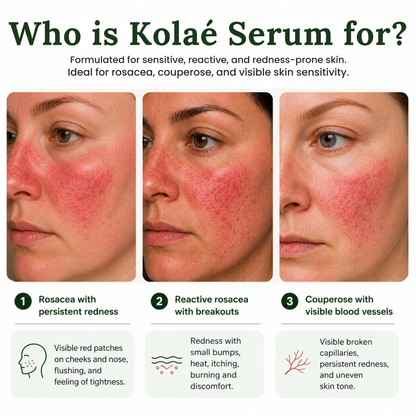 Kolaé Anti-Redness Serum